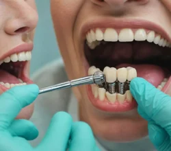 Ile kosztuje implant zęba w Gdańsku?