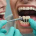 Ile kosztuje implant zęba w Gdańsku?
